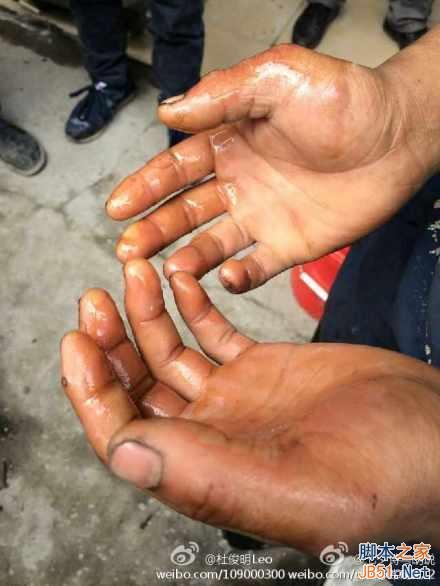 小伙玩小米手机突然爆炸 小米已回应